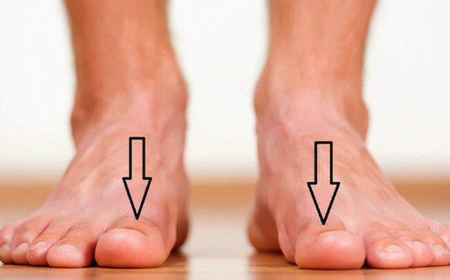 Có phải chân phải dễ bị nhột hơn chân trái không. Bách Khoa Tri Thức