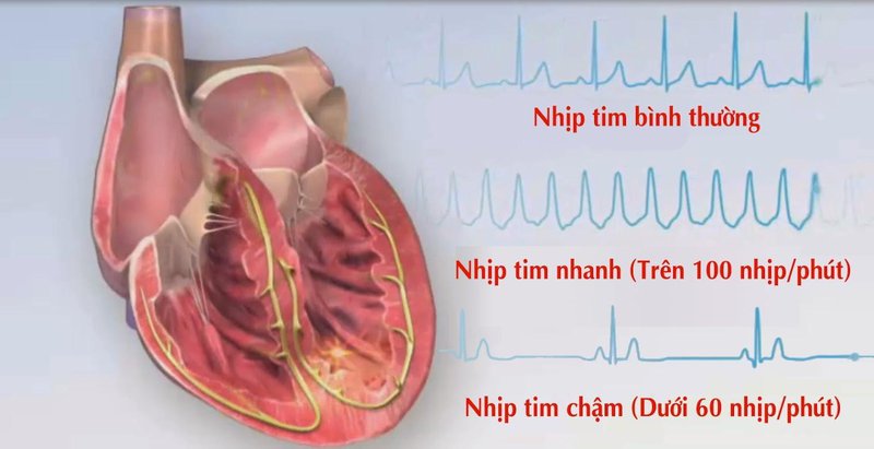Điều gì làm cho nhịp đập của tim thay đổi. Bách Khoa Tri Thức