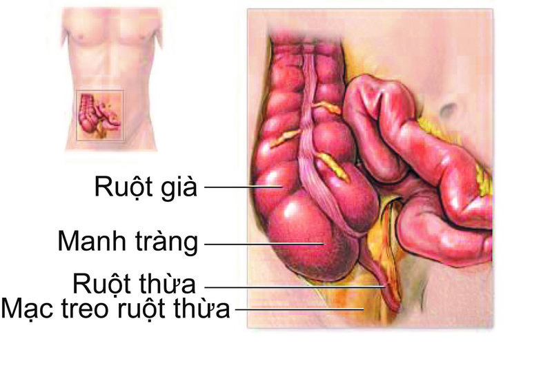 Ruột dư là cái gì. Bách Khoa Tri Thức