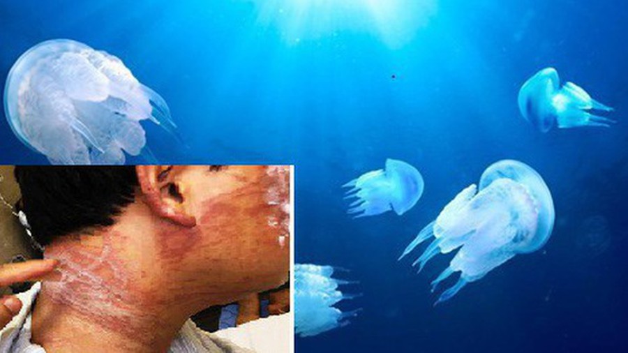 Sứa có nguy hiểm không. Bách Khoa Tri Thức