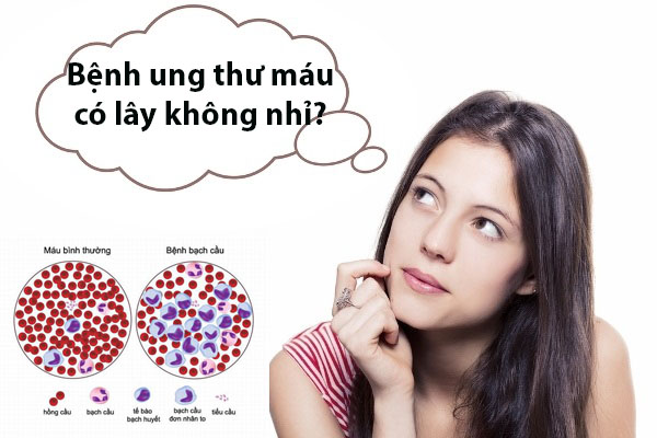 Ta có thể bị lây ung thư từ người khác hay không. Bách Khoa Tri Thức