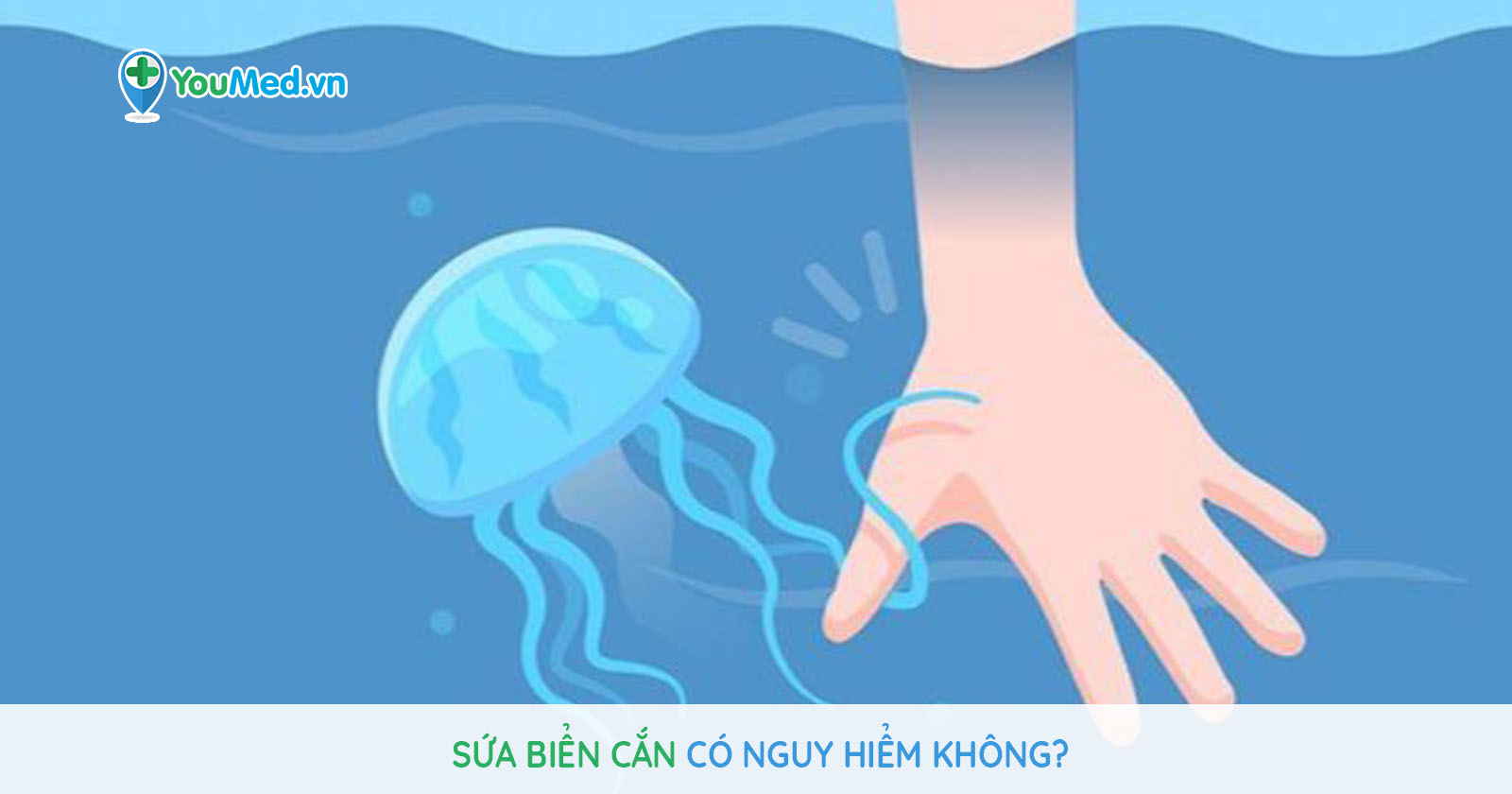 Sứa có thể cắn người. Thế Giới Động Vật